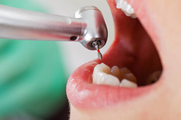 Best Emergency Pediatric Dentist  in Centreville, MD